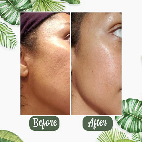 ⏰ Last 3 Hours! 🔥 Green Tea Deep Cleanse Mask – 70% OFF!