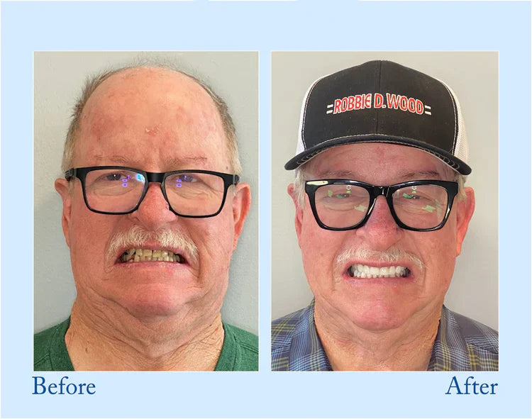 đĽ3 Hours Left: 60% OFF BBOJI⢠Toothpaste for Sensitive Teeth