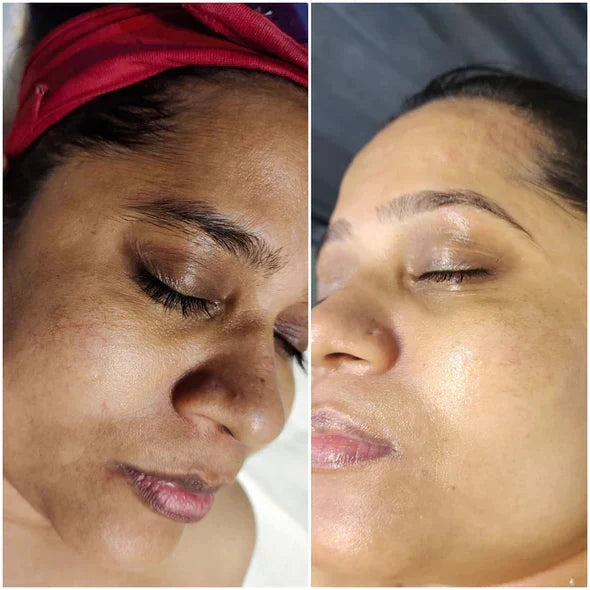 🔥 Only 3 Hours Left! 🌟 AQA™ Melanin Serum – Last Chance -83%!
