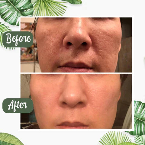 ⏰ Last 3 Hours! 🔥 Green Tea Deep Cleanse Mask – 70% OFF!