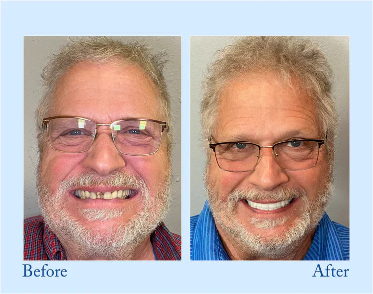 đĽ3 Hours Left: 60% OFF BBOJI⢠Toothpaste for Sensitive Teeth