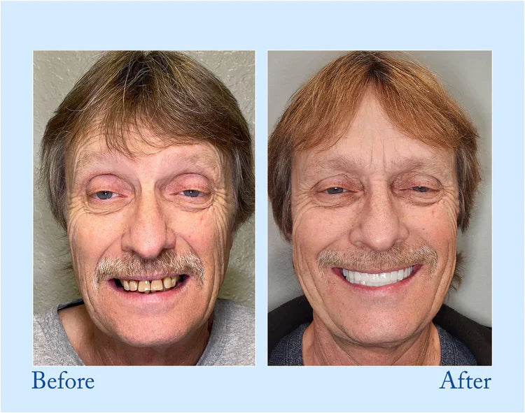 đĽ3 Hours Left: 60% OFF BBOJI⢠Toothpaste for Sensitive Teeth