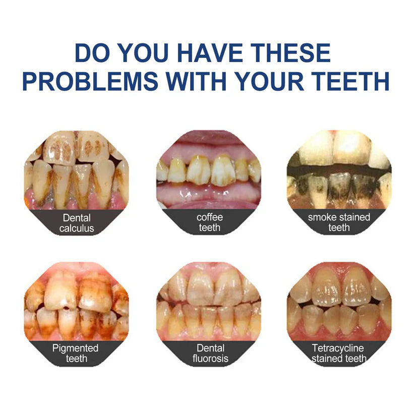 đĽ3 Hours Left: 60% OFF BBOJI⢠Toothpaste for Sensitive Teeth