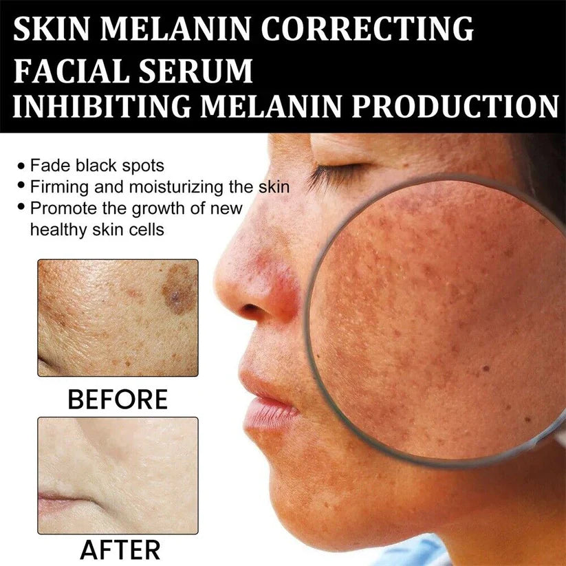 🔥 Only 3 Hours Left! 🌟 AQA™ Melanin Serum – Last Chance -83%!