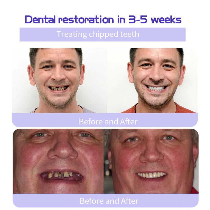 đĽ3 Hours Left: 60% OFF BBOJI⢠Toothpaste for Sensitive Teeth