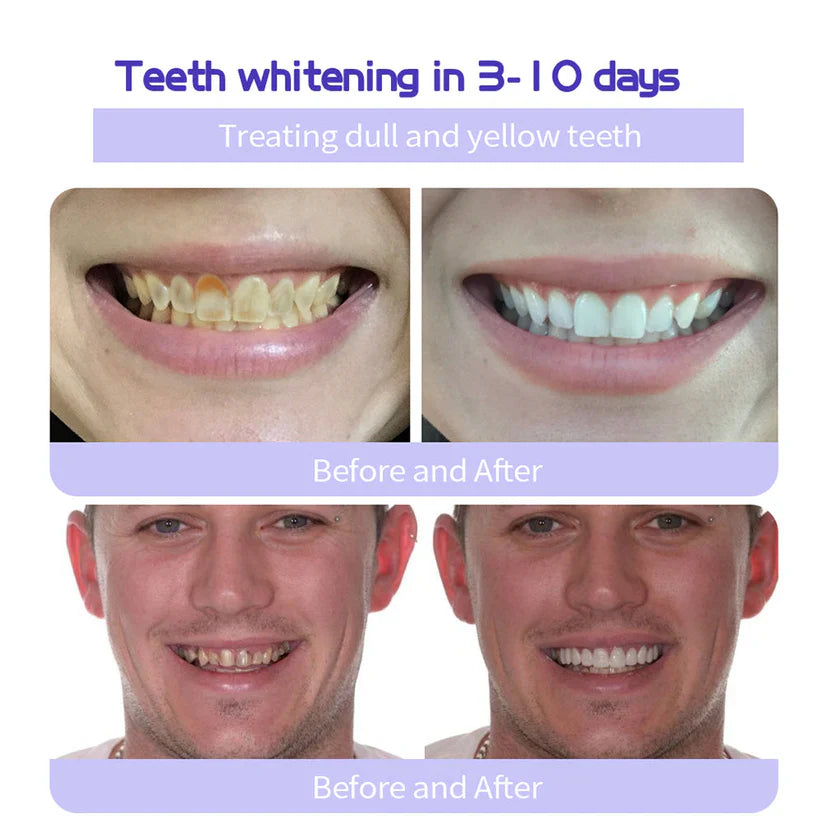 đĽ3 Hours Left: 60% OFF BBOJI⢠Toothpaste for Sensitive Teeth