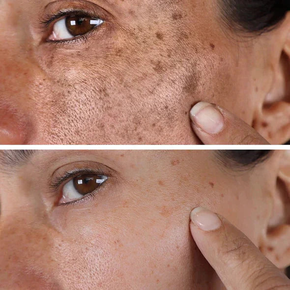 🔥 Only 3 Hours Left! 🌟 AQA™ Melanin Serum – Last Chance -83%!
