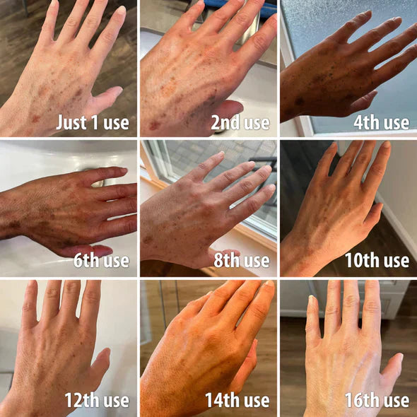 🔥 Only 3 Hours Left! 🌟 AQA™ Melanin Serum – Last Chance -83%!