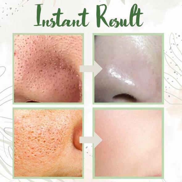 ⏰ Last 3 Hours! 🔥 Green Tea Deep Cleanse Mask – 70% OFF!