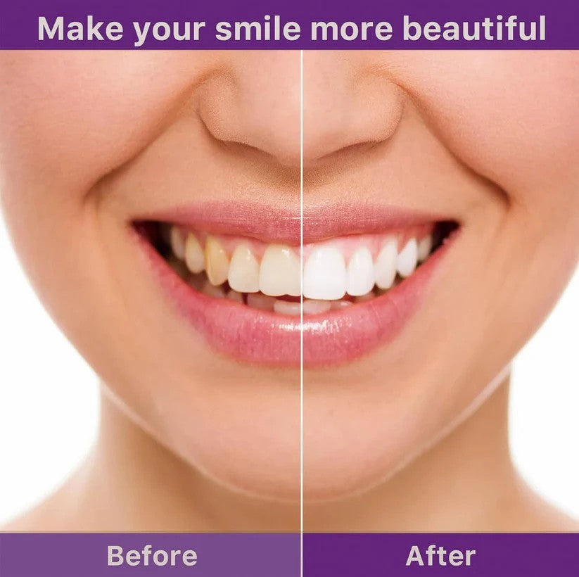 Final 3 Hours: 60% OFF🔥 AQA Teeth Whitening & Vegan Powder